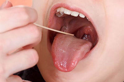 Phòng khám uy tín chuyên chữa trị viêm họng mãn tính kéo dài